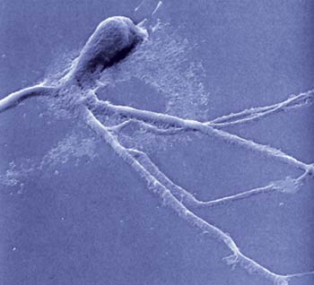 sinir hücresi nöron