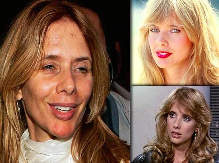 Rosanna Arquette