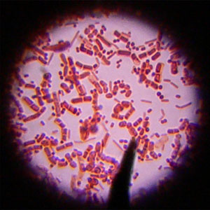 bakteri3
