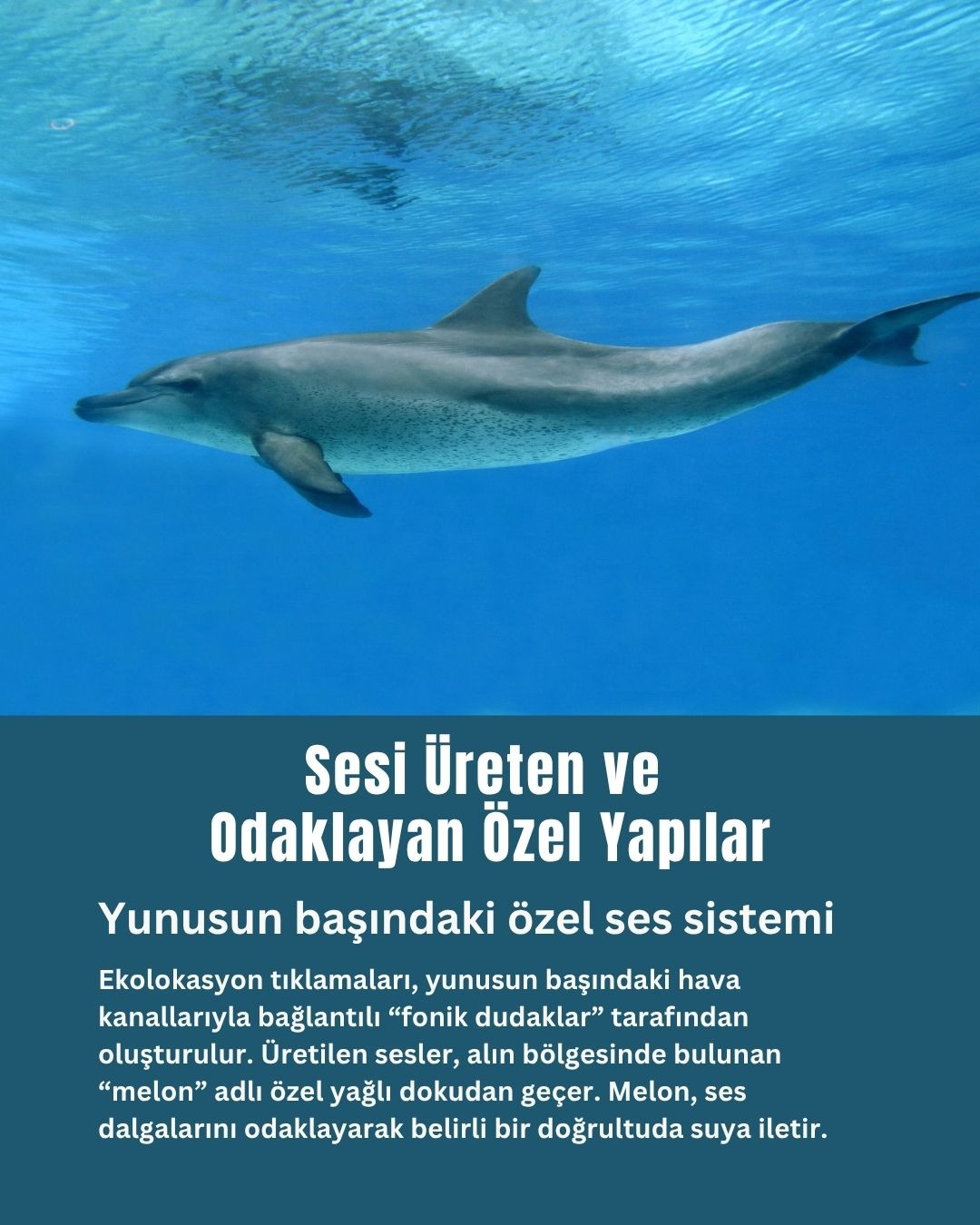  Sesi Üreten ve Odaklayan Özel Yapılar