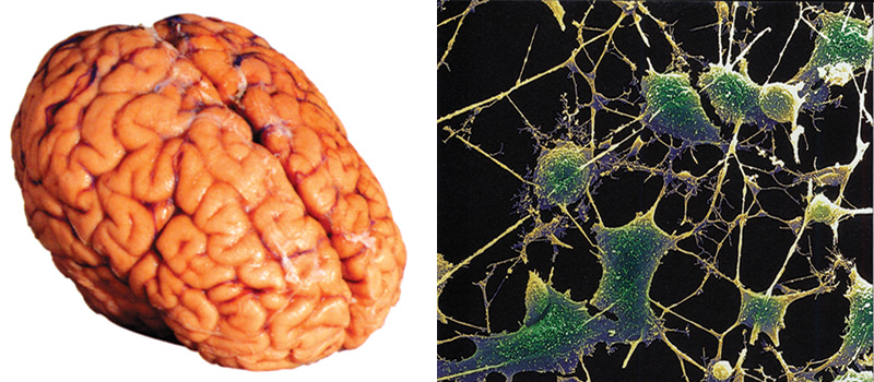 nöron Real Brain Noron Gercek Beyin