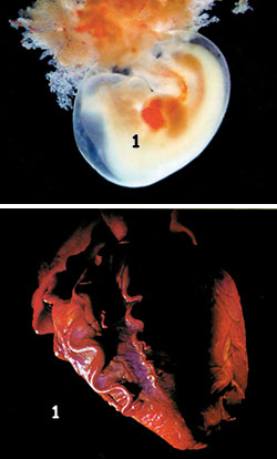  embriyo, yetişkin kalbi 