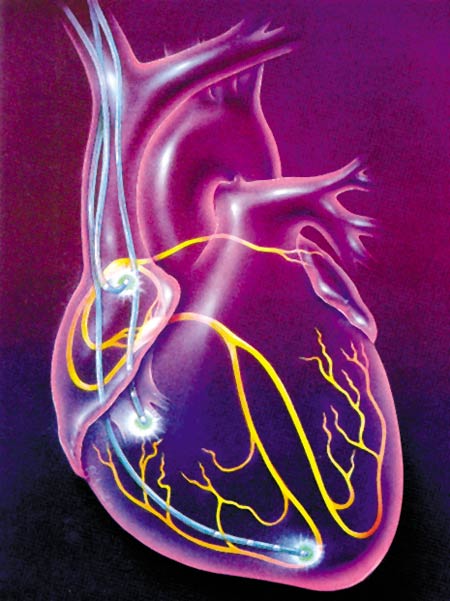 heart generator